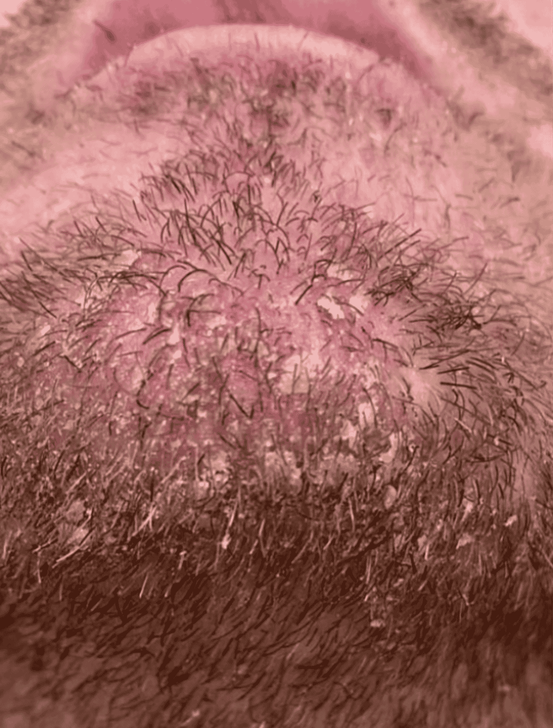 Alt Image