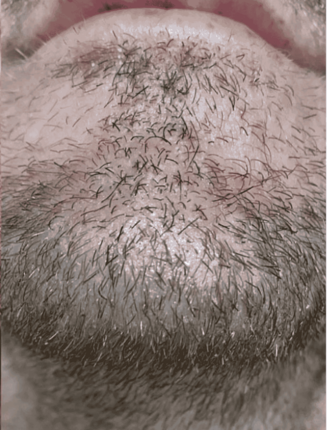 Alt Image