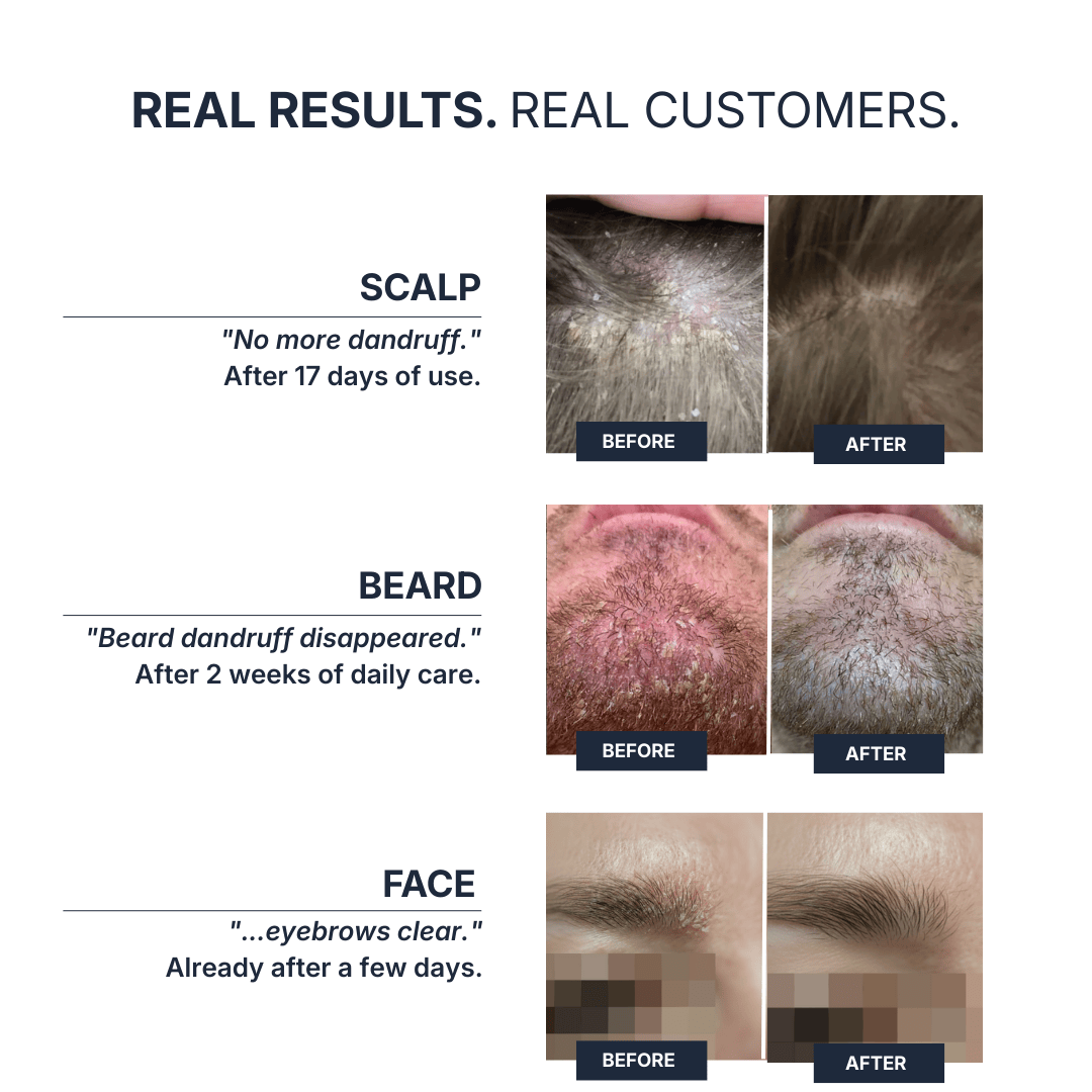 DermCare® System